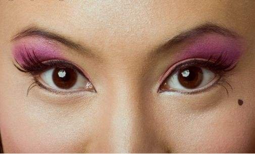 哪里可以去痣的