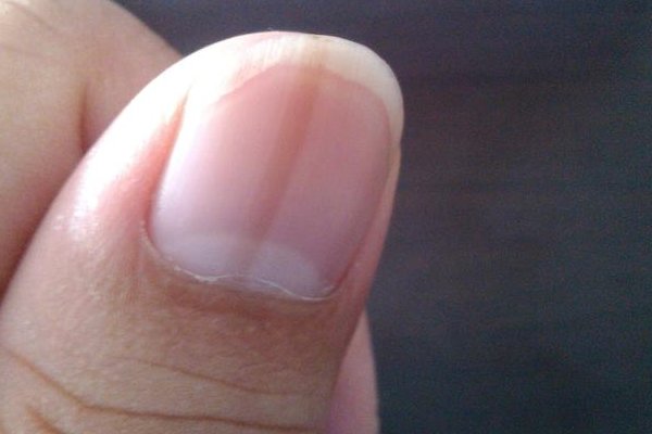 什么样的指甲是健康的指甲?