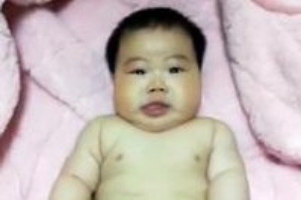 5月婴儿被曝使用抑菌霜后成“大头娃娃”，孩子该怎么办?