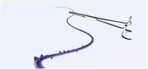 脸部线雕副作用