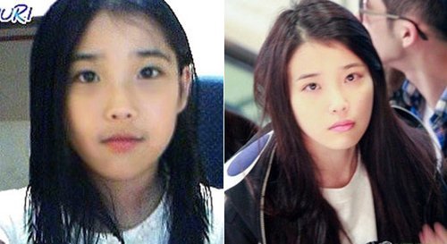 Iu李智恩整容了吗?看她和以前的照片不太一样啊
