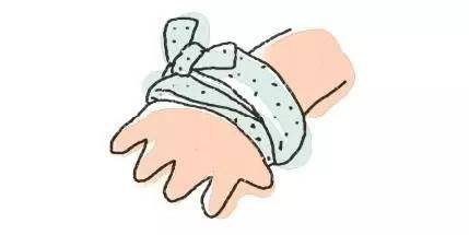 烫伤水泡要不要弄破？