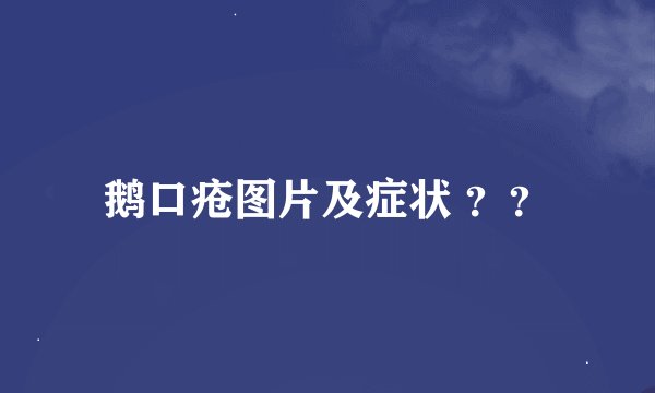 鹅口疮图片及症状 ？？
