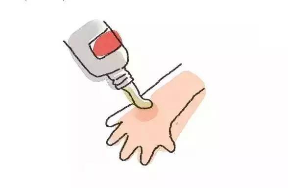 烫伤水泡要不要弄破？