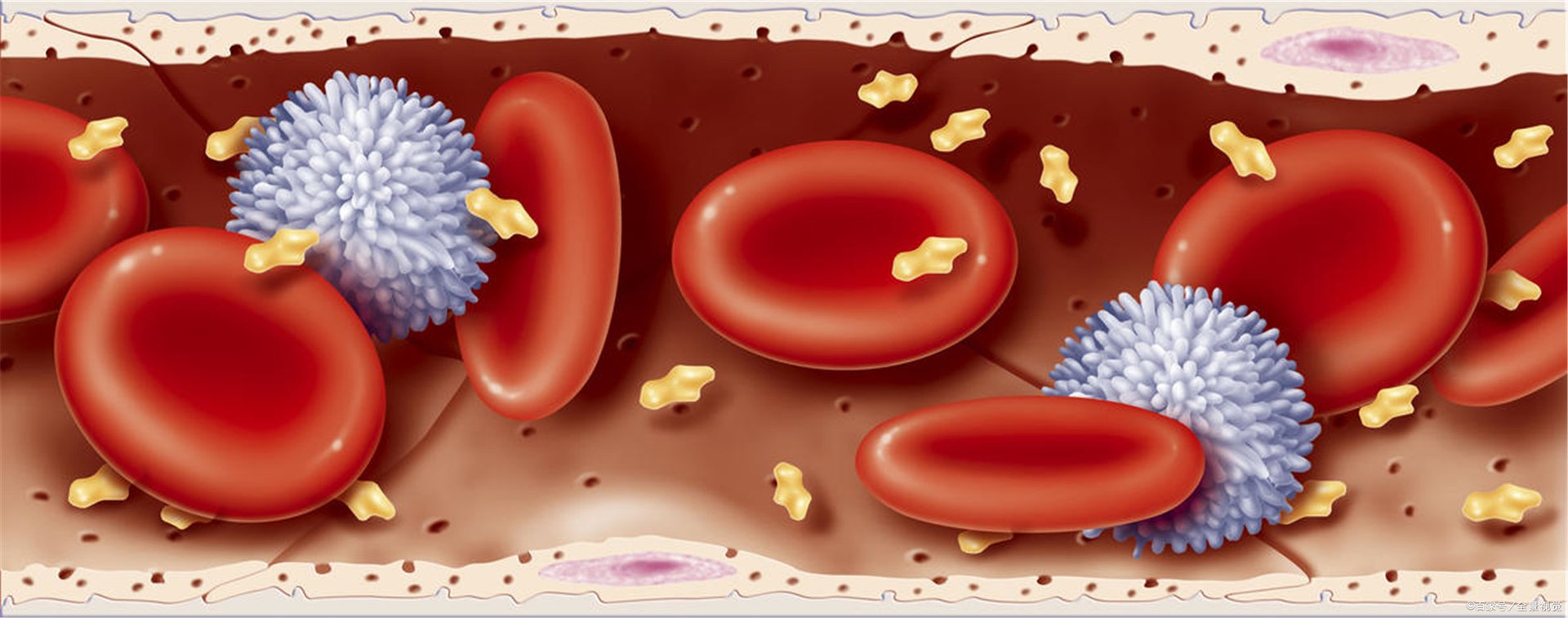 为什么毛细血管痣会越来越多