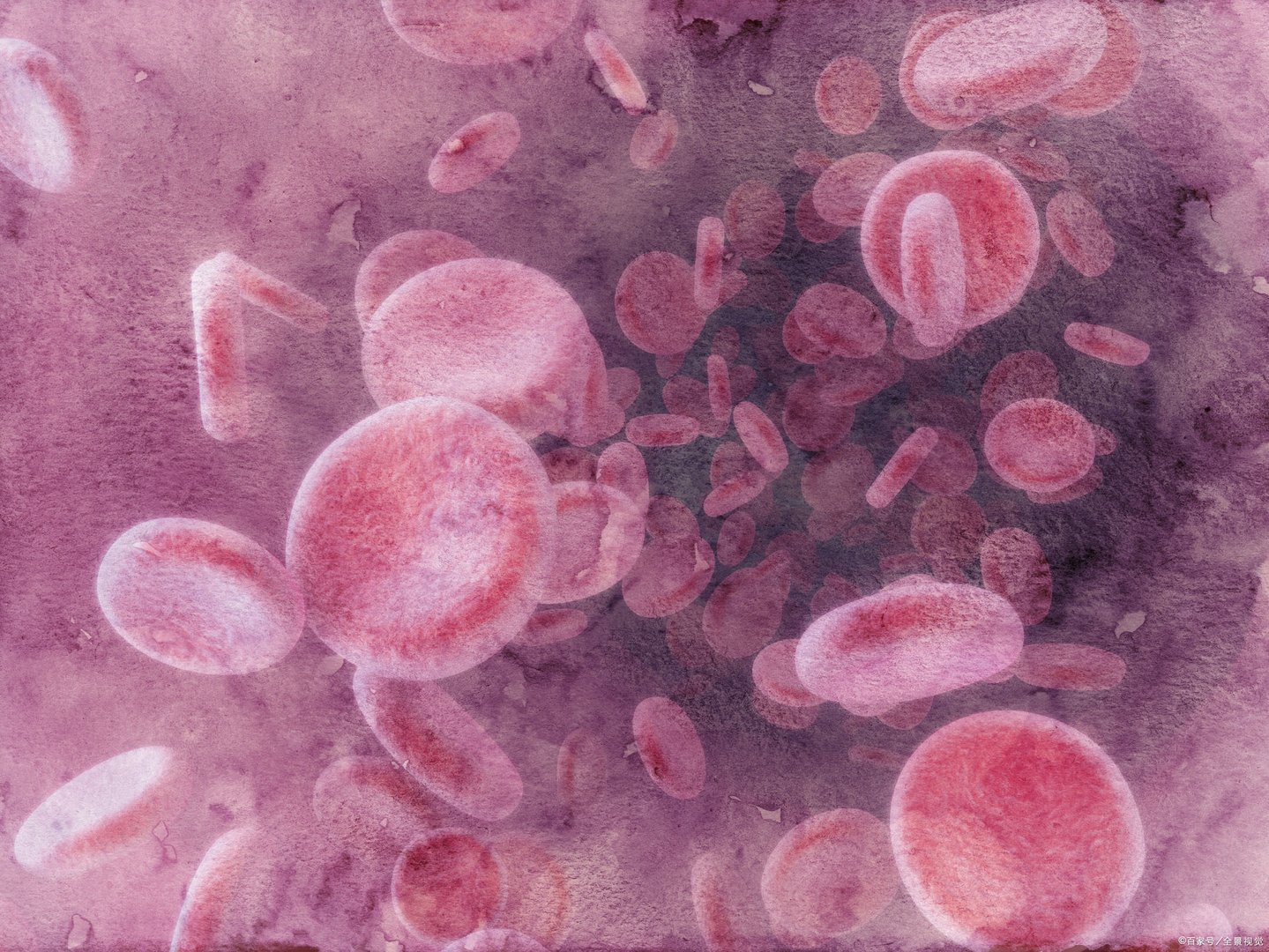 为什么毛细血管痣会越来越多