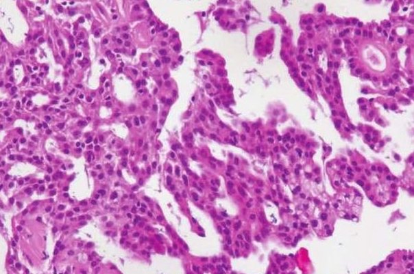 异型性的名词解释