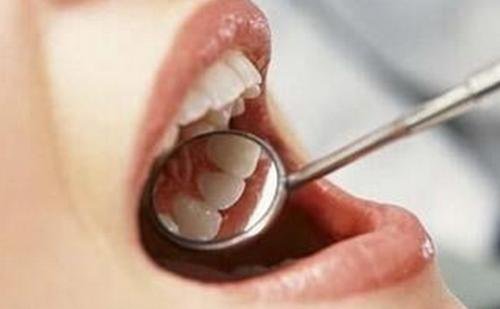 现在在北京拔智齿得多少钱一颗？