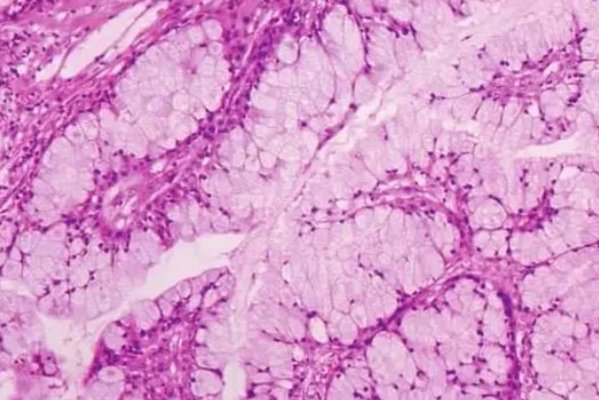 异型性的名词解释