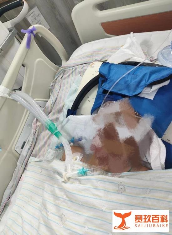 河南7岁男童遭男子暴力袭击，椅子砸头致重伤入ICU