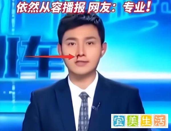 苏州电视台出现播出事故，主持人直播中突然流鼻血，导播束手无策