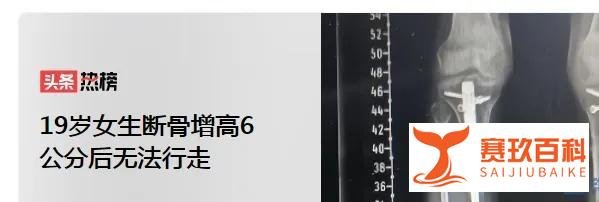 19岁女生断骨增高6公分后无法行走与AI画作拍卖在上海拍出110万高价