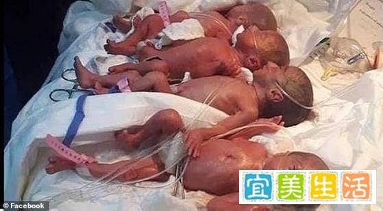 人类奇迹！非洲妈妈一胎生下5女4男