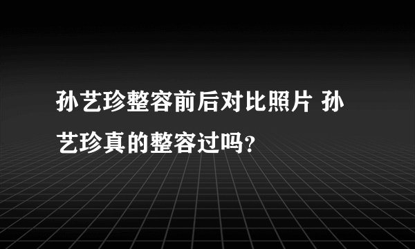孙艺珍整容前后对比照片 孙艺珍真的整容过吗？