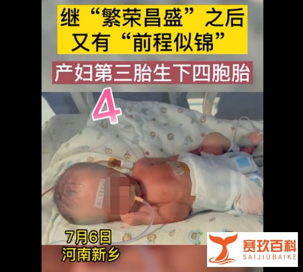 新乡一产妇第三胎生下龙凤四胞胎!这4种情况更容易生出多胞胎