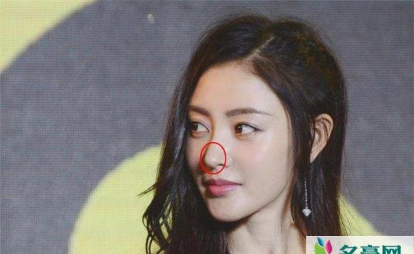 张天爱鼻子整过吗 整容前后对比简直判若两人真的整过吗