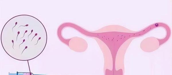 未婚女性可以使用精子库供精“去父留子”吗?目前不行