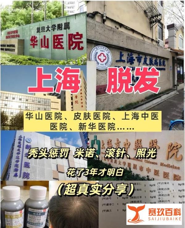 上海看脱发3年总结，华山、皮肤医院、中医院……
