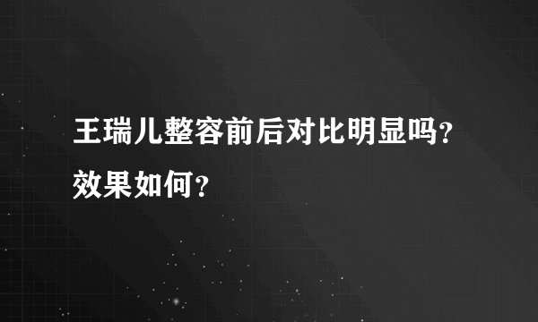 王瑞儿整容前后对比明显吗？效果如何？