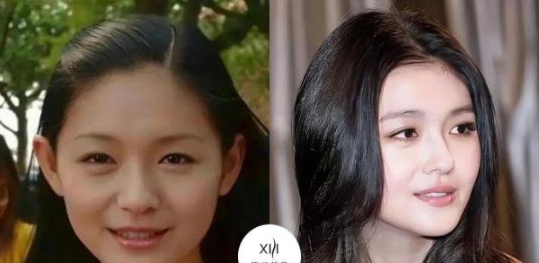 大S的整容历程,号称湾湾界的美容大王怎么也有马失前蹄的时候?