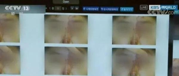 这种可怕的“幽灵手术”已经让数百人死亡