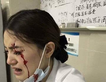 华西医院护士被病人家属推门撞伤