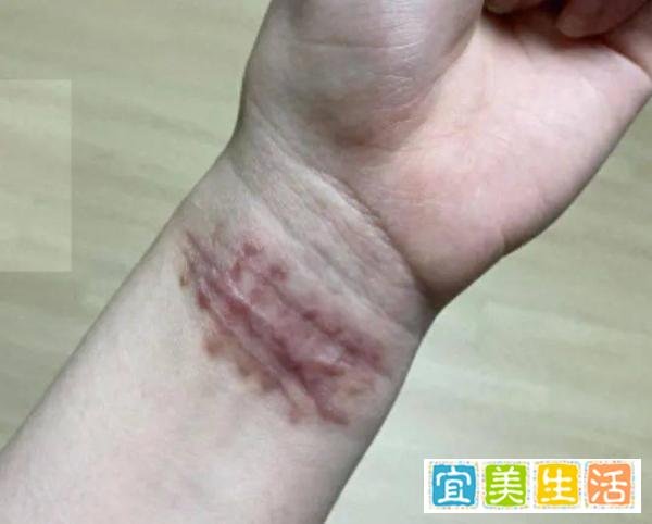 韩国女团权珉娥14岁被轮X！曾遭队员霸凌luo聊被骗8万