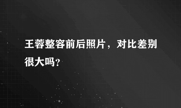 王蓉整容前后照片，对比差别很大吗？