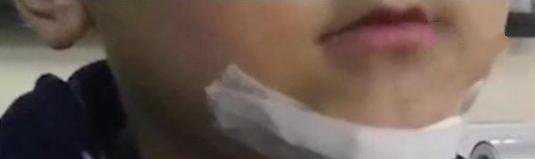 模仿抖音弄伤弟弟 这到底是怎么一回事?