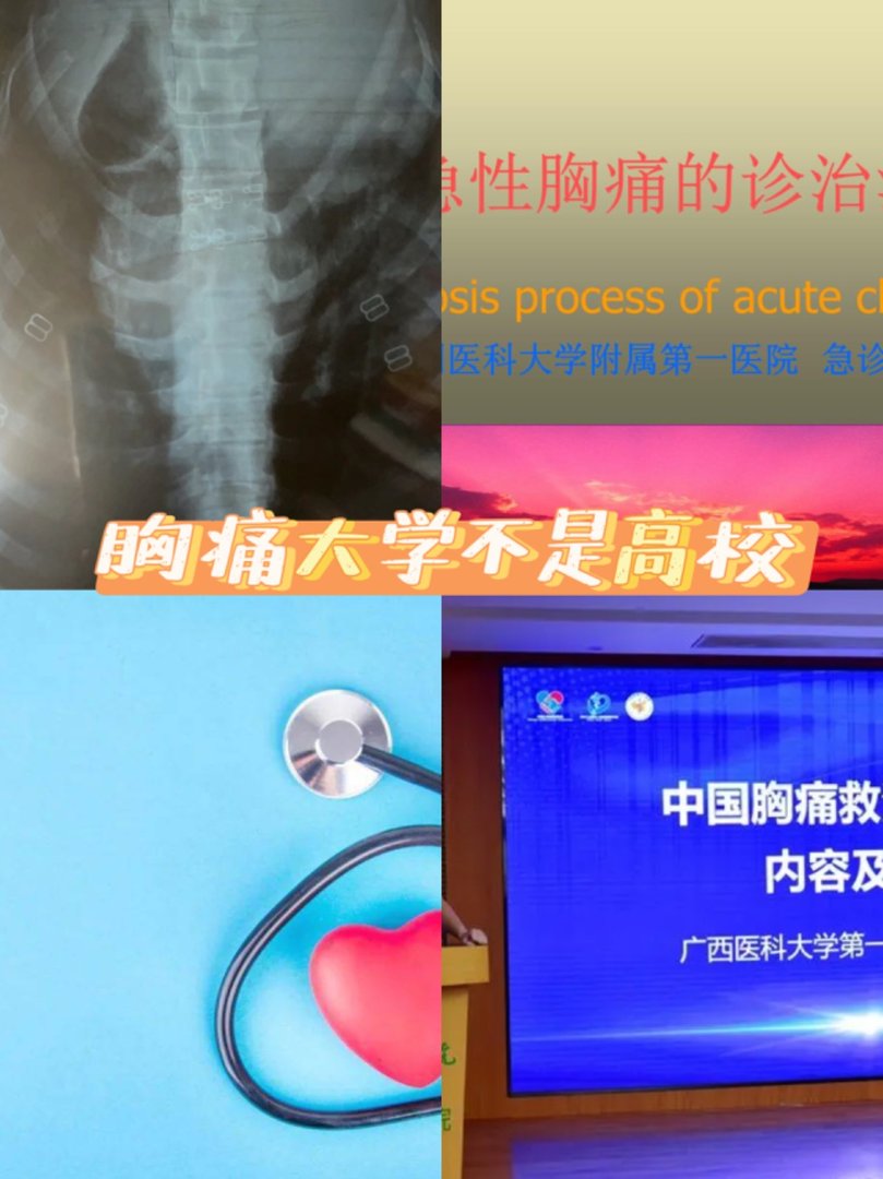 胸痛大学不是高校