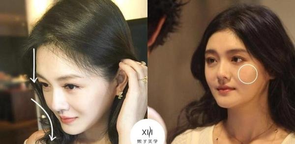 大S的整容历程,号称湾湾界的美容大王怎么也有马失前蹄的时候?