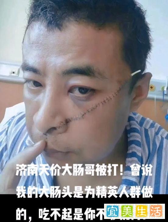 面条哥刚消失，济南大肠哥又因为嘴贱被打成猪头，一点不亏他们！