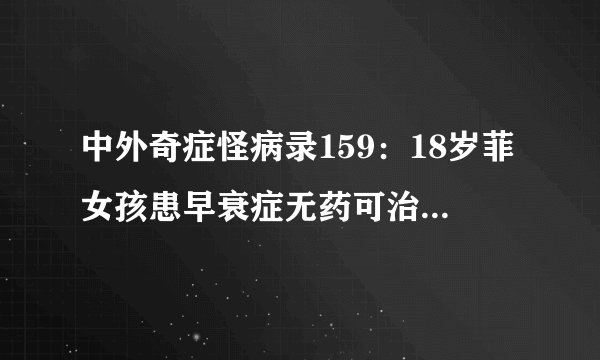 中外奇症怪病录159：18岁菲女孩患早衰症无药可治 患病儿童常死于衰老疾病