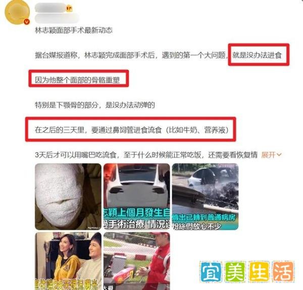 曝林志颖近况:进食困难需靠鼻饲，可能会留下永久性伤疤