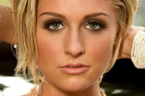 激光祛痘要花多少钱