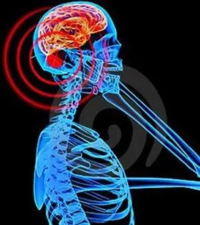 手机辐射有多致命?真相竟是这样(图)