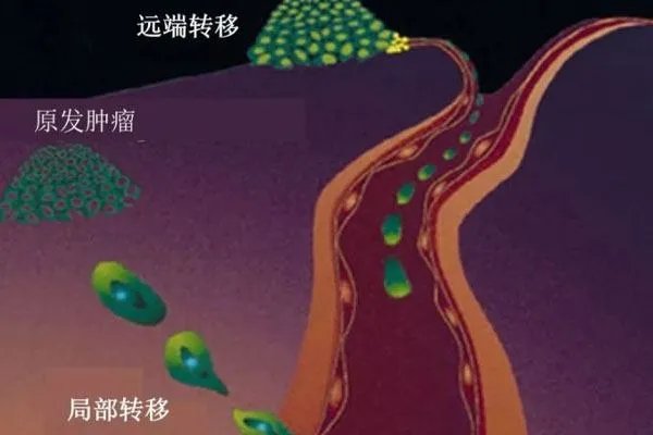 第二批抗癌药和罕见病药原料明年零关税,为何癌症始终无法被治愈?