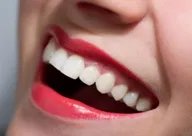牙齿如何变白小妙招