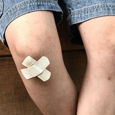 类风湿的症状是什么