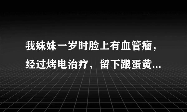 我妹妹一岁时脸上有血管瘤，经过烤电治疗，留下跟蛋黄大小的疤痕，现在不知道怎么治疗，希望专家给点宝贵意..