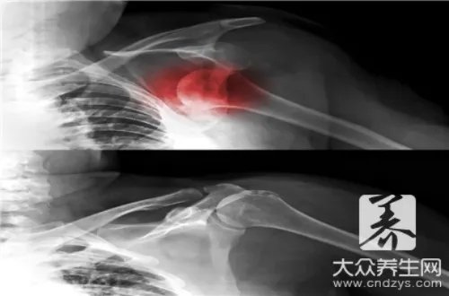 磁共振成像的原理