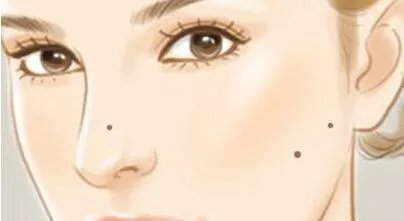 激光点痣会疼吗