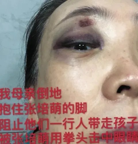 短跑名将婚内出轨，并多次实施家暴，是运动员都这样吗？