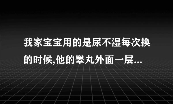 我家宝宝用的是尿不湿每次换的时候,他的睾丸外面一层皮都会垂下来