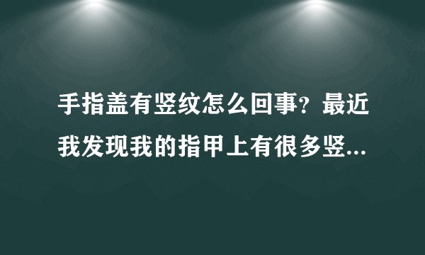 手指盖有竖纹怎么回事？最近我发现我的指甲上有很多竖纹，请问一下手指盖有竖纹怎么回事？