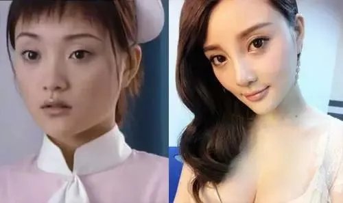哪些女明星本来很好看却要整容，还越整越丑？