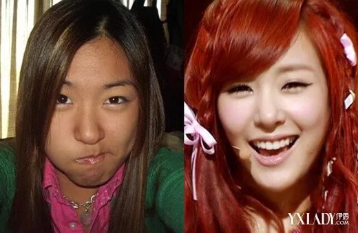 金泰妍整容前后照片对比曝光少女时代成员以前居然长这样