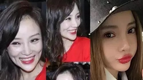 哪些女明星本来很好看却要整容，还越整越丑？