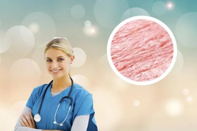 牛皮癣用什么药最有效