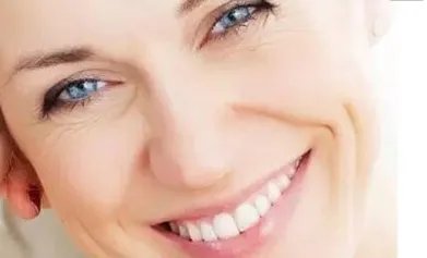 祛除法令纹的最好方法